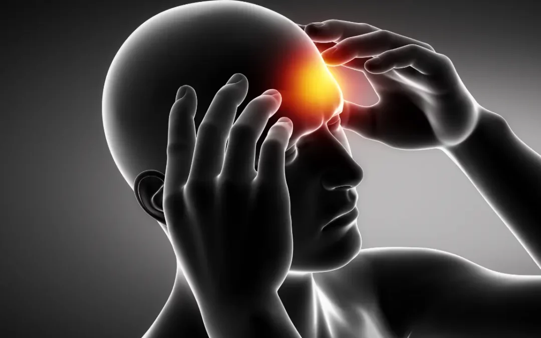 What Do Chiropractors Do For Migraines